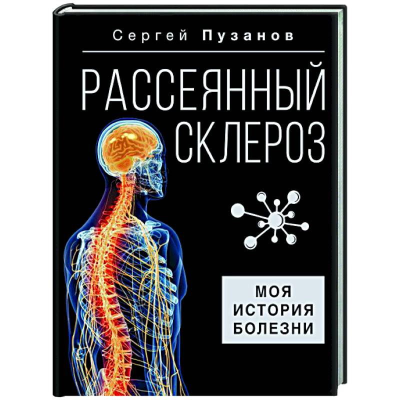 Право на любовь и прикосновения: о сексуальности и рассеянном склерозе. Управление симптомами