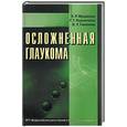 russische bücher: Мулдашев, Корнилаева, Галимова - Осложненная глаукома