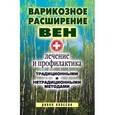 russische bücher: Филатова С.В. - Варикозное расширение вен. Лечение и профилактика традиционными и нетрадиционными методами