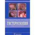 russische bücher: Савельева Г. М. - Гистероскопия. Атлас и руководство