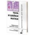 russische bücher: Андреева Юлия Юрьевна - Опухоли тела и шейки матки