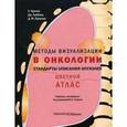 russische bücher: Хричак Хедвига - Методы визуализации в онкологи. Стандарты описания опухолей. Цветной атлас