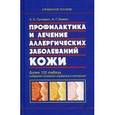 russische bücher: Ситкевич А.Е., Казеко А.Г. - Профилактика и лечение аллергических заболеванийкожи: справочное пособие