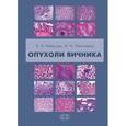 russische bücher: Нейштадт Э.Л. - Опухоли яичника