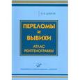 russische bücher: Дубров Э.Я. - Переломы и вывихи  Атлас рентгенограмм.