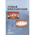 russische bücher: Кулаков А. А. - Зубная имплантация