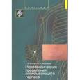 russische bücher: Суслина З.А., Максимова М.Ю. - Неврологические проявления опоясывающего герпеса. Пособие для врачей