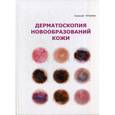 russische bücher: Гетьман А.Д. - Дерматоскопия новообразований кожи.