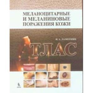 russische bücher: Ламоткин - Меланоцитарные и меланиновые поражения кожи. Атлас