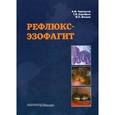 russische bücher: Черноусов Александр Федорович - Рефлюкс - эзофагит