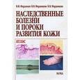 russische bücher: Мордовцев Владимир Николаевич - Наследственные болезни и пороки развития кожи. Атлас