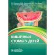 russische bücher: Аверин Василий Иванович - Кишечные стомы у детей. Руководство