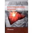 russische bücher: Чжао А. В. - Холангиоцеллюлярная карцинома