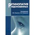 russische bücher: Нероев Владимир Владимирович - Ретинопатия недоношенных