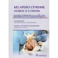 russische bücher: Ренцо Джан Карло Ди - Кесарево сечение. Новое о старом. Иллюстрированное практическое руководство