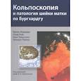 russische bücher: Жирарди Ф. - Кольпоскопия и патология шейки матки по Бургхардту