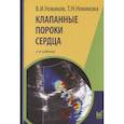 russische bücher: Новиков В.И. - Клапанные пороки сердца