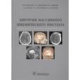 russische bücher: Крылов В.В. и др. - Хирургия массивного ишемического инсульта