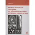russische bücher: Холин А.В. - Магнитно-резонансная томография при заболеваниях и травмах центральной нервной системы