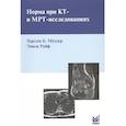 russische bücher: Мёллер Т.Б. - Норма при КТ- и МРТ-исследованиях. Мёллер Т.Б.