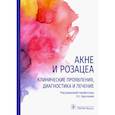 russische bücher: под.ред.Кругловой Л. - Акне и розацеа.Клинические проявления,диагностика и лечение