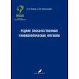 russische bücher: Ульрих Елена Александровна - Редкие злокачественные гинекологические опухоли