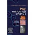 russische bücher: Под ред. Чен У.И., Уордли Э. - Рак молочной железы