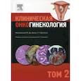 russische bücher: Под ред. Ф.Дж. Дисаи, У.Т. Крисмана - Клиническая онкогинекология. В 3 томах. Том 2