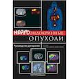 russische bücher: Под ред. Кэплин М., Кволс Л. - Нейроэндокринные опухоли. Руководство для врачей