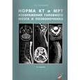 russische bücher: Труфанов Г.Е. - Норма КТ-и МРТ-изображений головного мозга и позвоночника