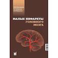 russische bücher: Максимова М.Ю. - Малые инфаркты головного мозга