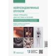 russische bücher: Беретта Джордано - Нейроэндокринные опухоли. Новые принципы диагностики и лечения. Руководство