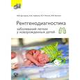 russische bücher: Дегтярева М.В., Горбунов А.В., Мазаев А.П. - Рентгенодиагностика заболеваний легких у новорожденных детей. + DVD