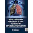russische bücher: Хубутия М.Ш., Петриков С.С., Гасанов А.М. - Эндоскопические внутрипросветные технологии в трансплантации легких
