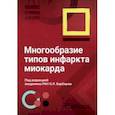 russische bücher: Барбараш Ольга Леонидовна - Многообразие типов инфаркта миокарда